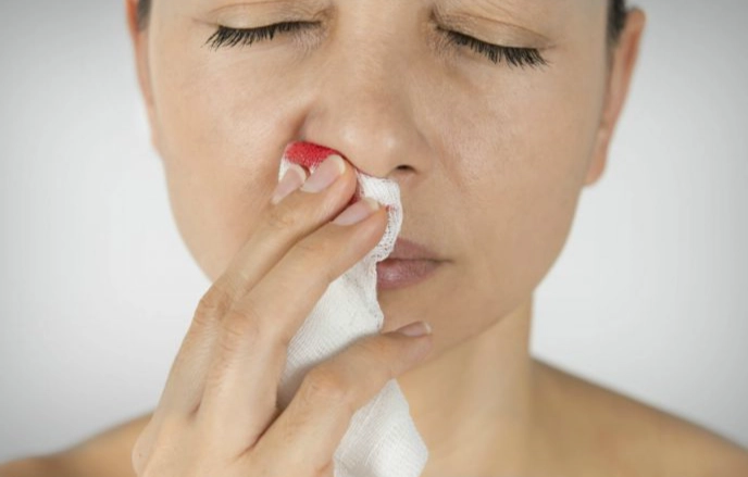 nose bleeding dream interpretation