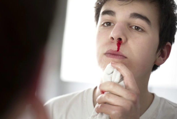 dream of a bloody nose meaning