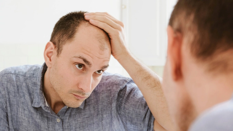 bald dream interpretation