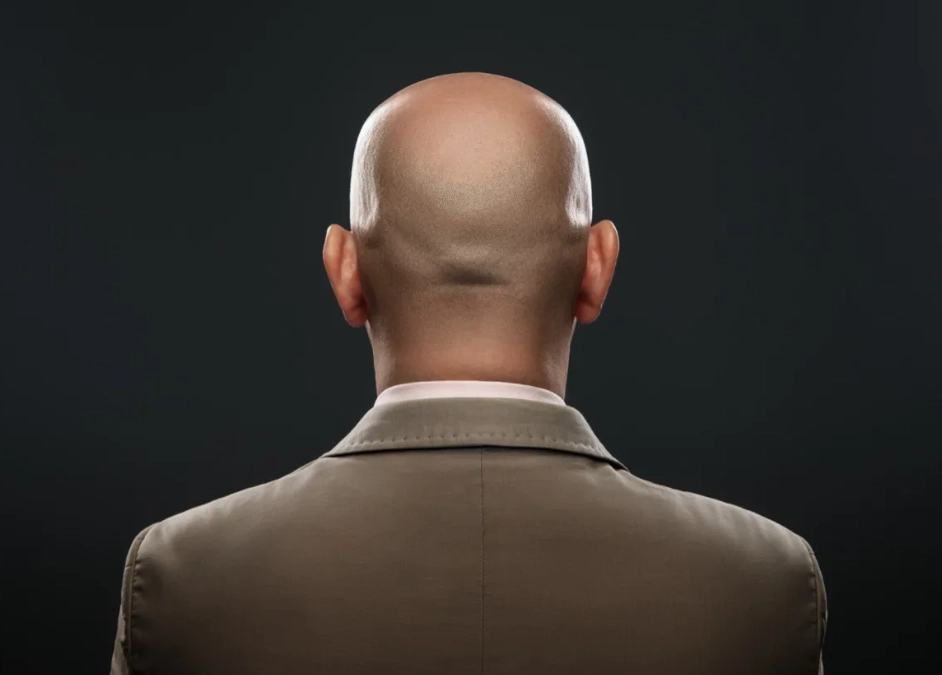 dreaming of hair loss